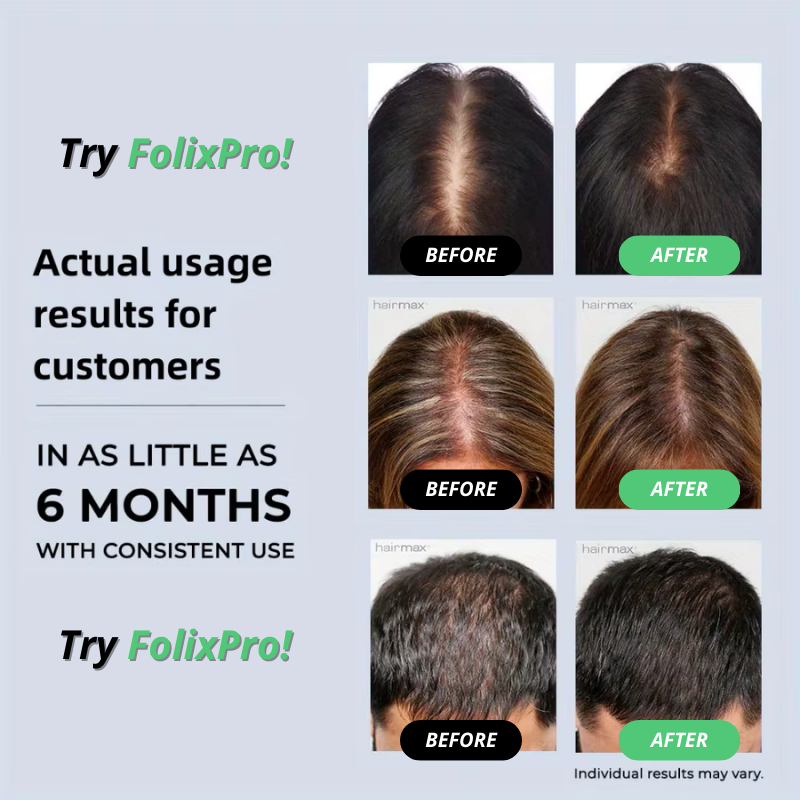 FolixPro™